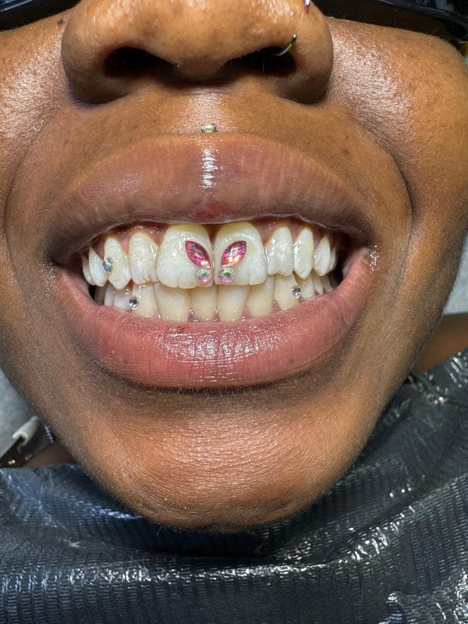 Dental Jewellery — 1