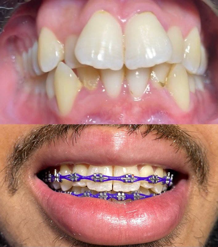 Smiles we've transformed — 5