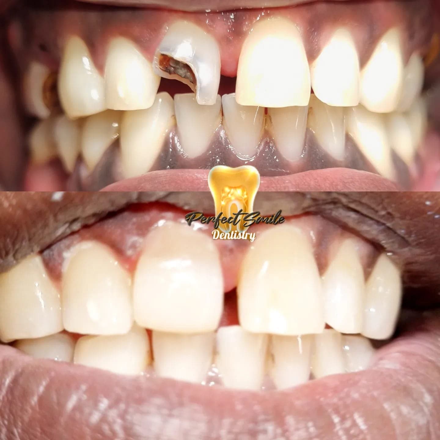 Smiles we've transformed — 6