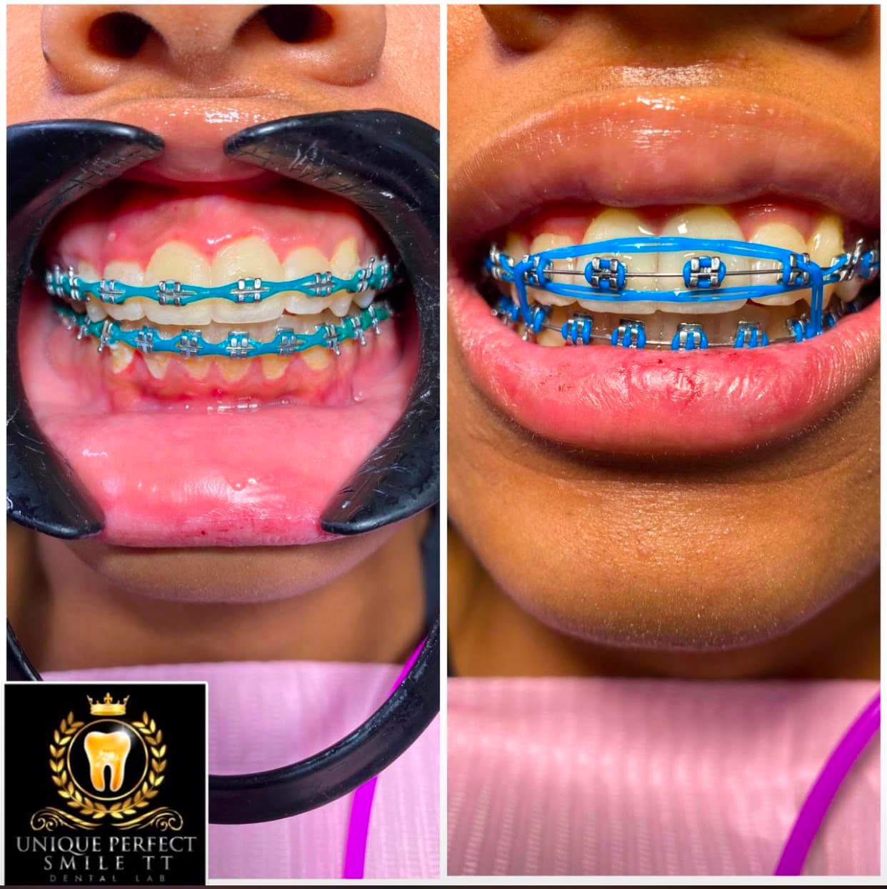 Smiles we've transformed — 10