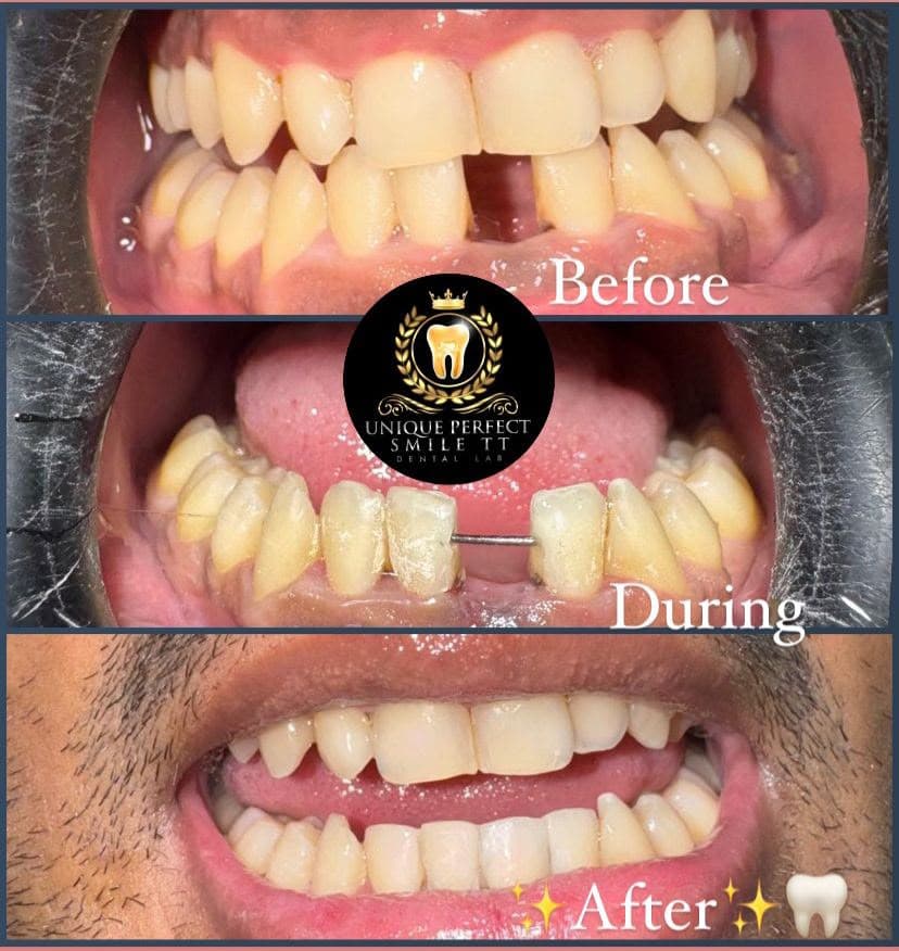 Smiles we've transformed — 11