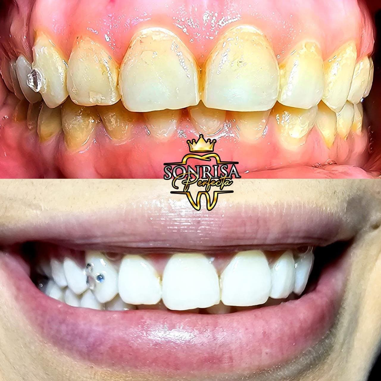 Smiles we've transformed — 13