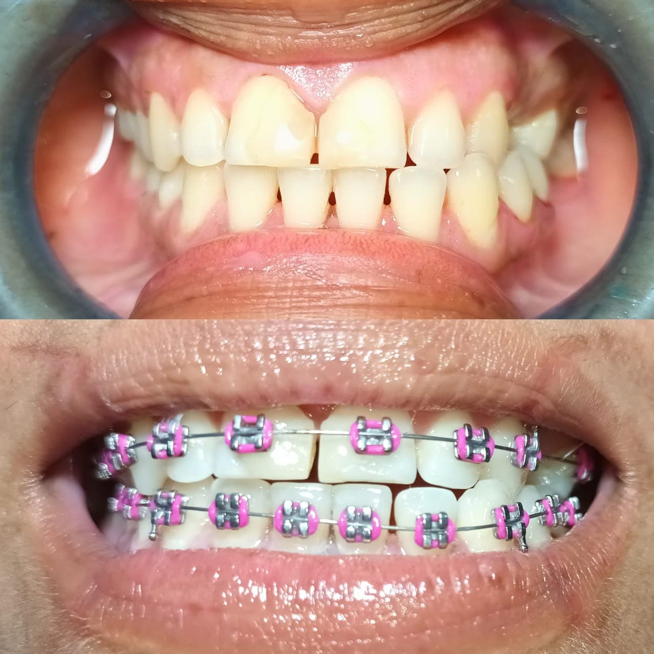 Smiles we've transformed — 18