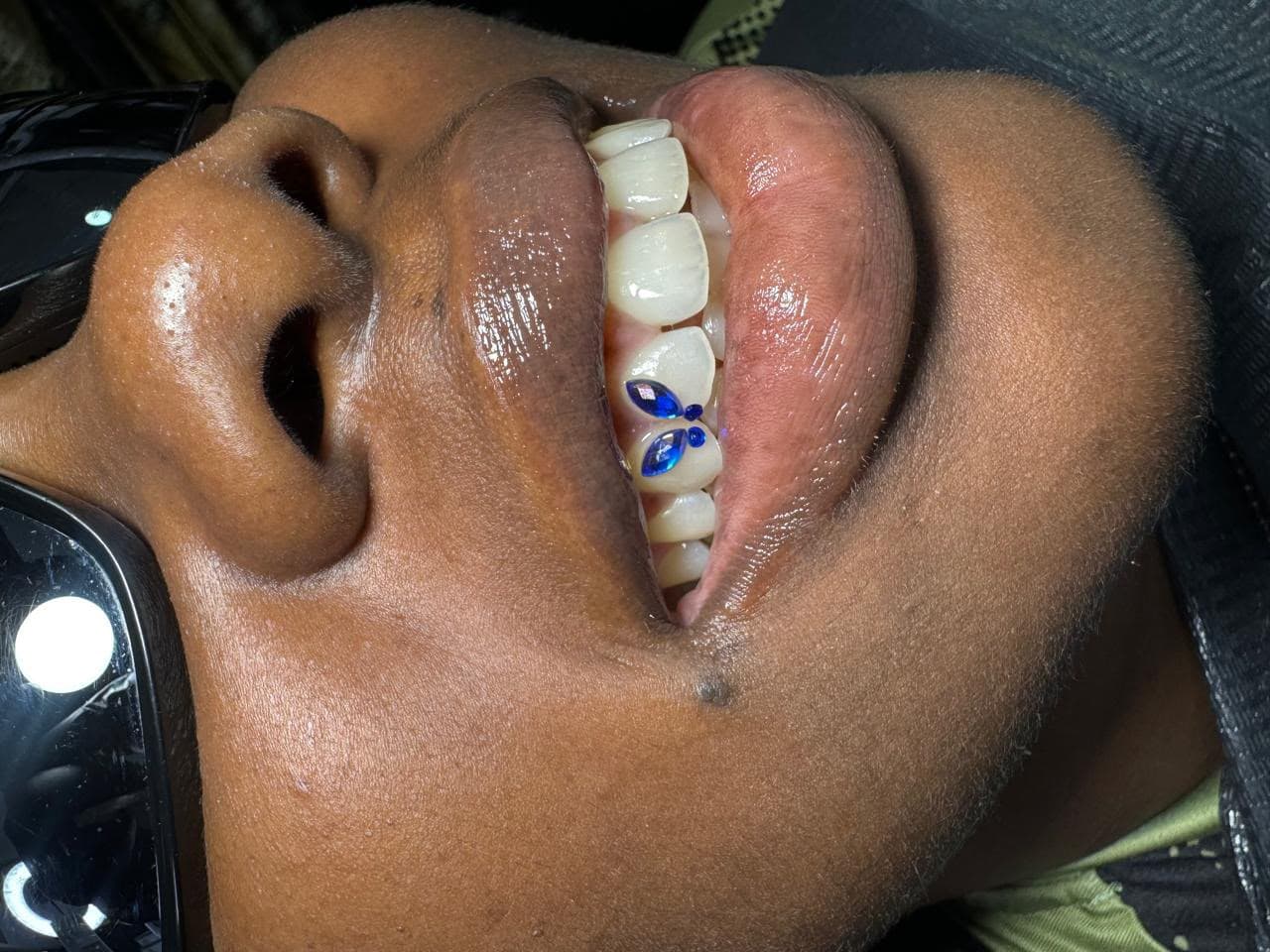 Smiles we've transformed — 20