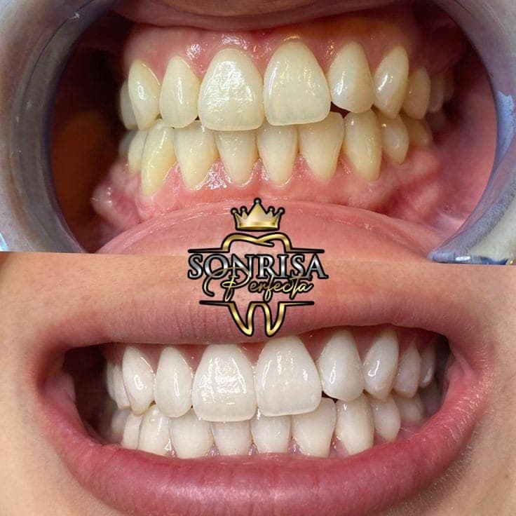 Smiles we've transformed — 26