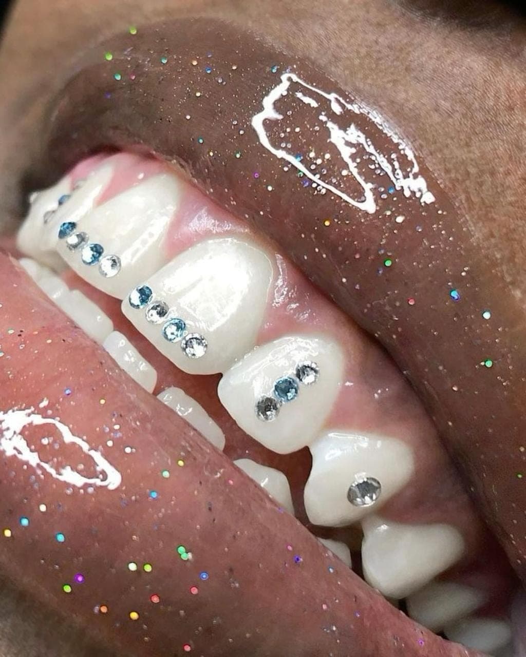 Smiles we've transformed — 32