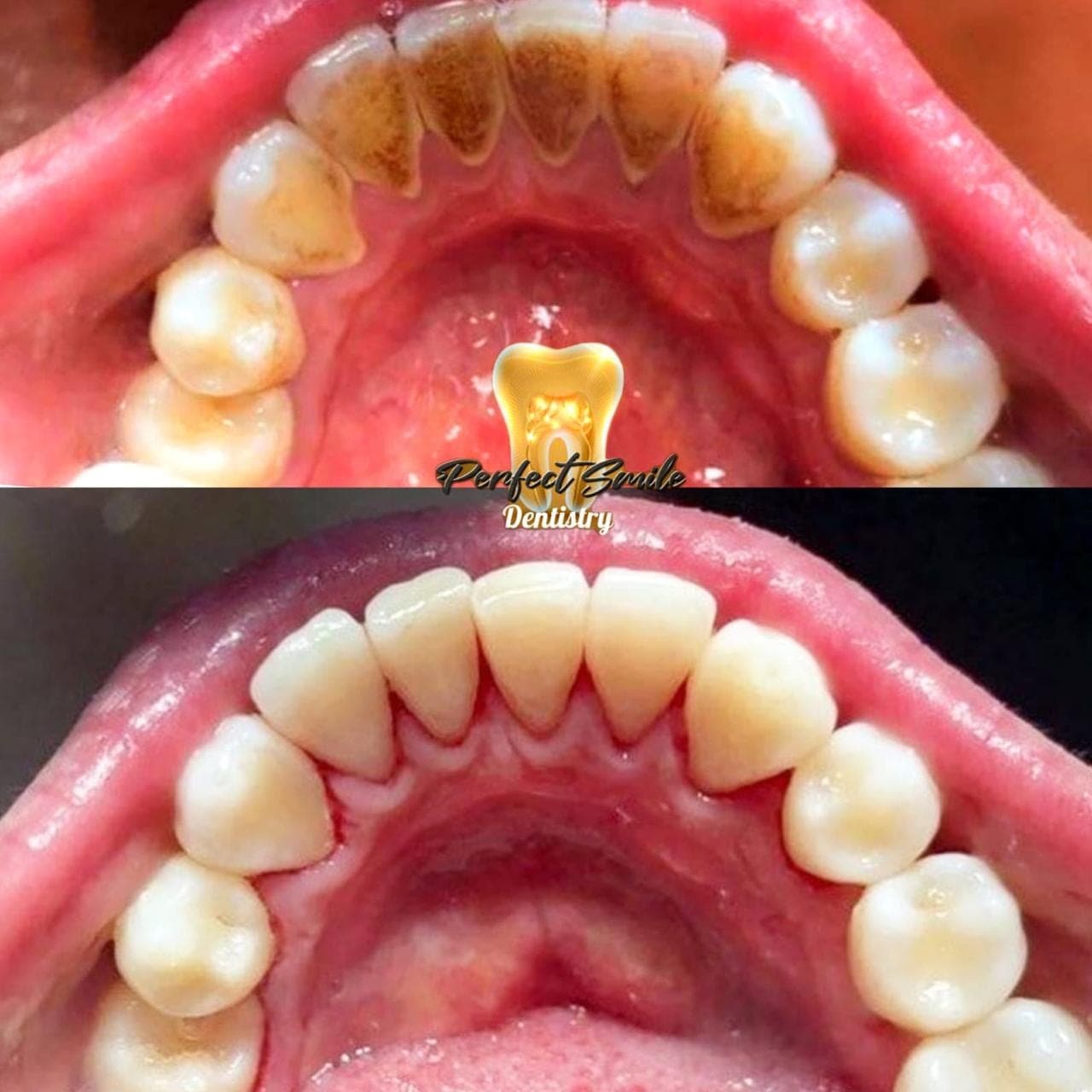 Smiles we've transformed — 33