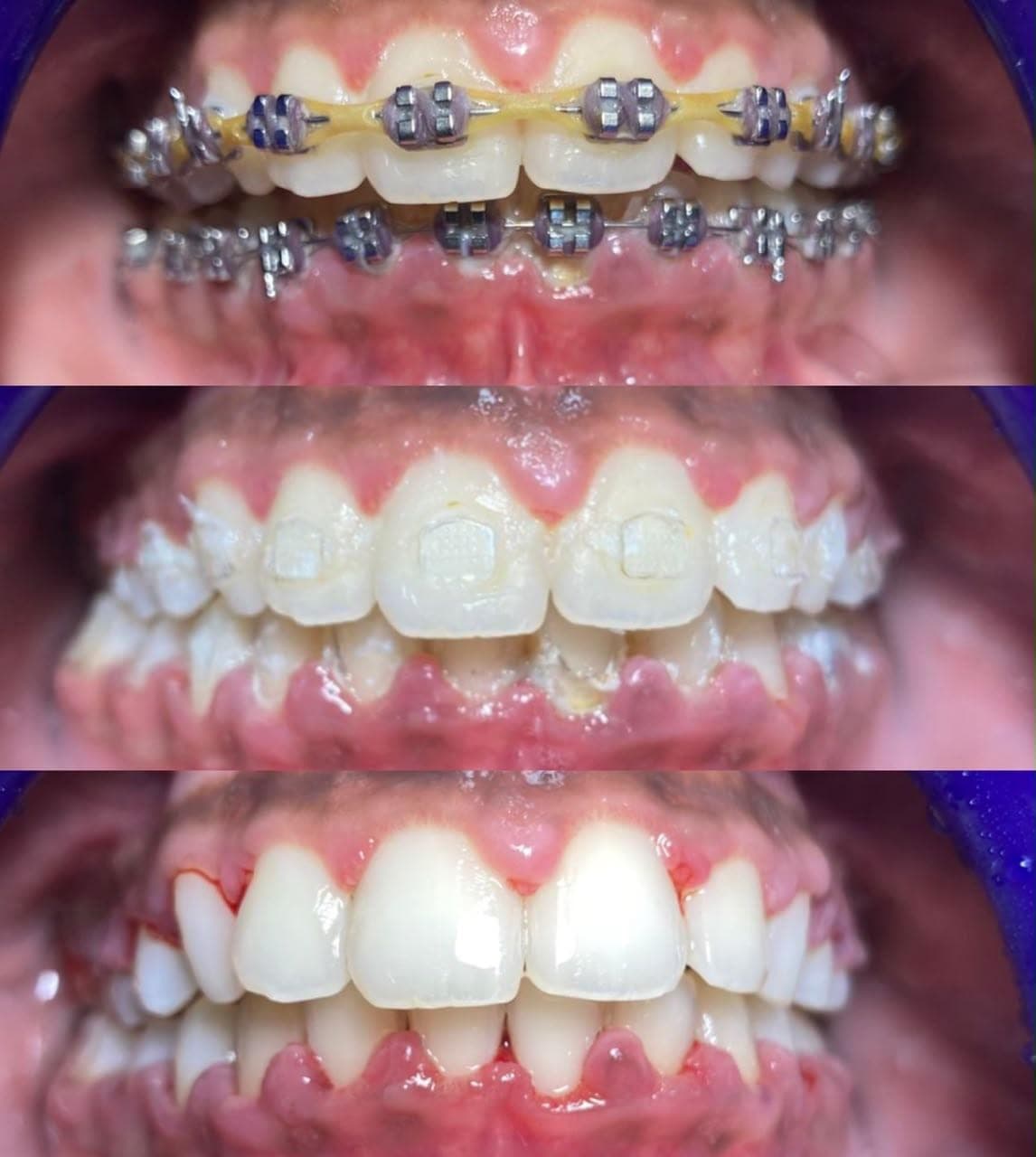 Smiles we've transformed — 34
